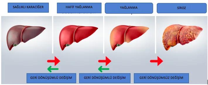 Karaciğer Yağlanması (fatty Liver) Olan Ağır Siklet Sporcularda Kolin Kullanımının Önemi
