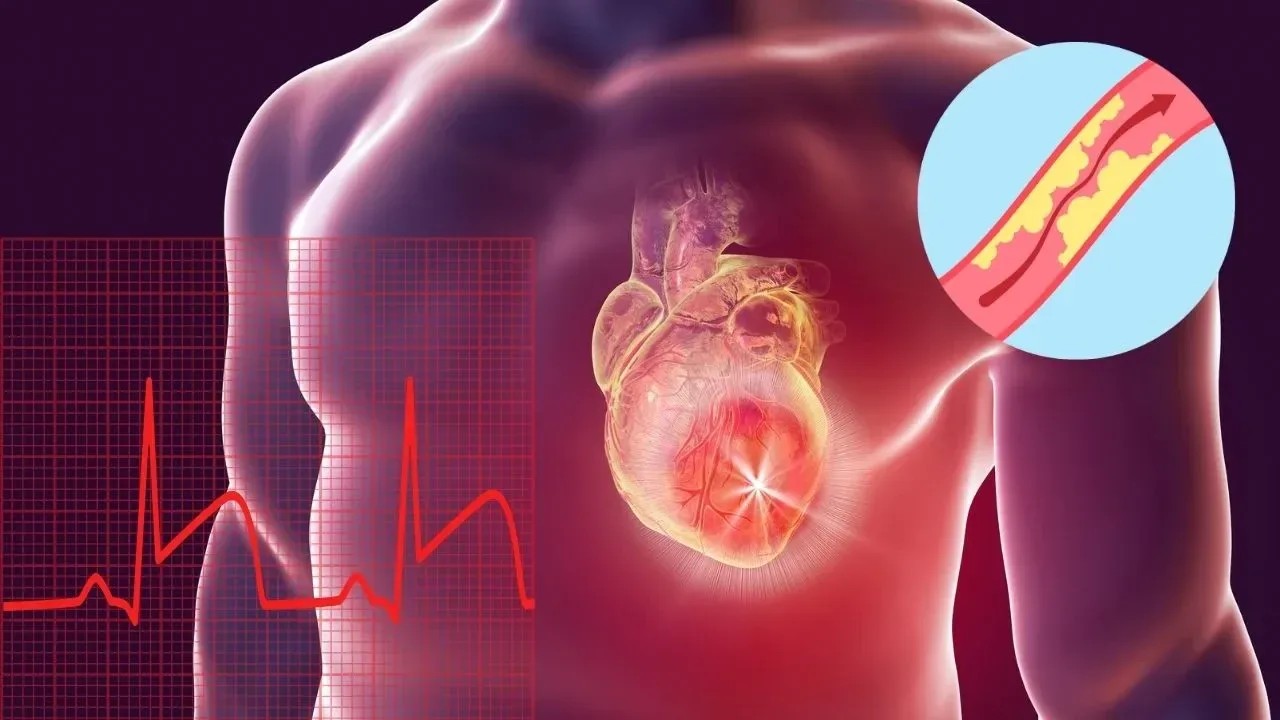 Sporda Kalp Büyümesi (hipertrofi) Riski Olanların Kesinlikle Kaçınması Gereken Supplementler 2 Sporda Kalp Büyümesi (hipertrofi) Riski Olanların Kesinlikle Kaçınması Gereken Supplementler